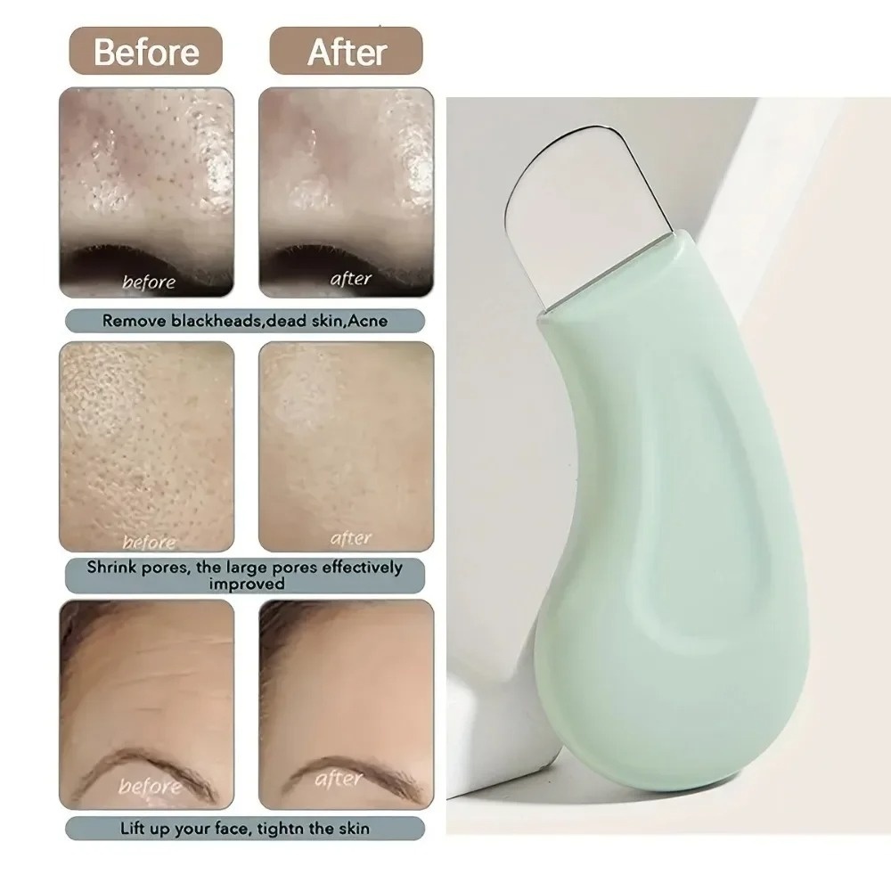 딥 클렌징 블랙헤드 화이트헤드 제거 도구 실리콘 페이셜 - Skincare Routine 리뷰 및 가격