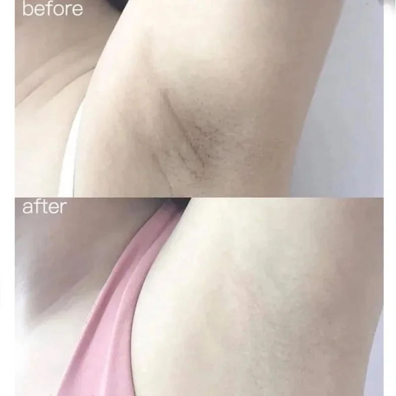 알파 아르부틴 콜라겐 미백 바디 세럼, 피부 미백, 다 - Alpha Arbutin Serum 리뷰 및 가격