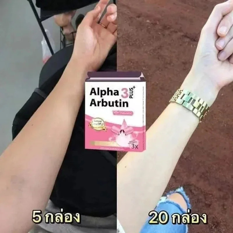알파 알부틴 3 플러스 파우더 믹스 로션, 피부 미백  - Alpha Arbutin Serum 리뷰 및 가격