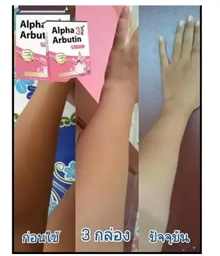 알파 알부틴 3 플러스 파우더 믹스 로션, 피부 미백  - Alpha Arbutin Serum 리뷰 및 가격